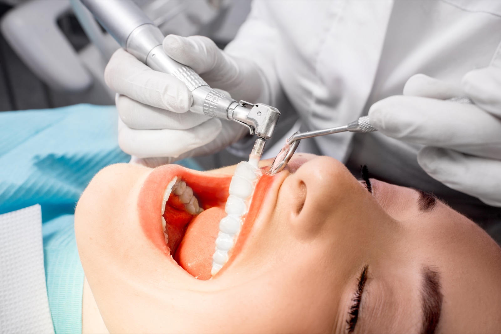 Patient receiving a professional teeth cleaning at Rasmussen Prosthodontics